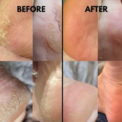 Lisseur de Pieds Électrique