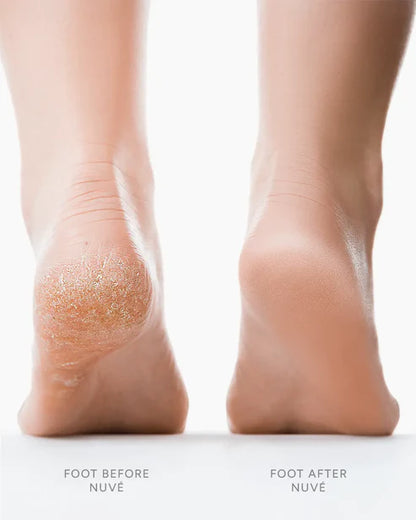 Lisseur de Pieds Électrique